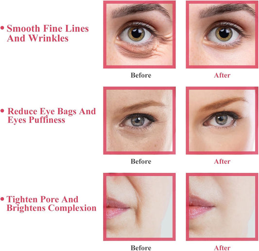 Ice Globes for Facials, 2PCS Ice Globes, Facial Globes, Face Globes, Cooling Globes, Facial Massager Tools for Face Neck & Eyes, Daily Beauty, Tighten Skin, anti Ageing, Reduce Puffy and Wrinkle